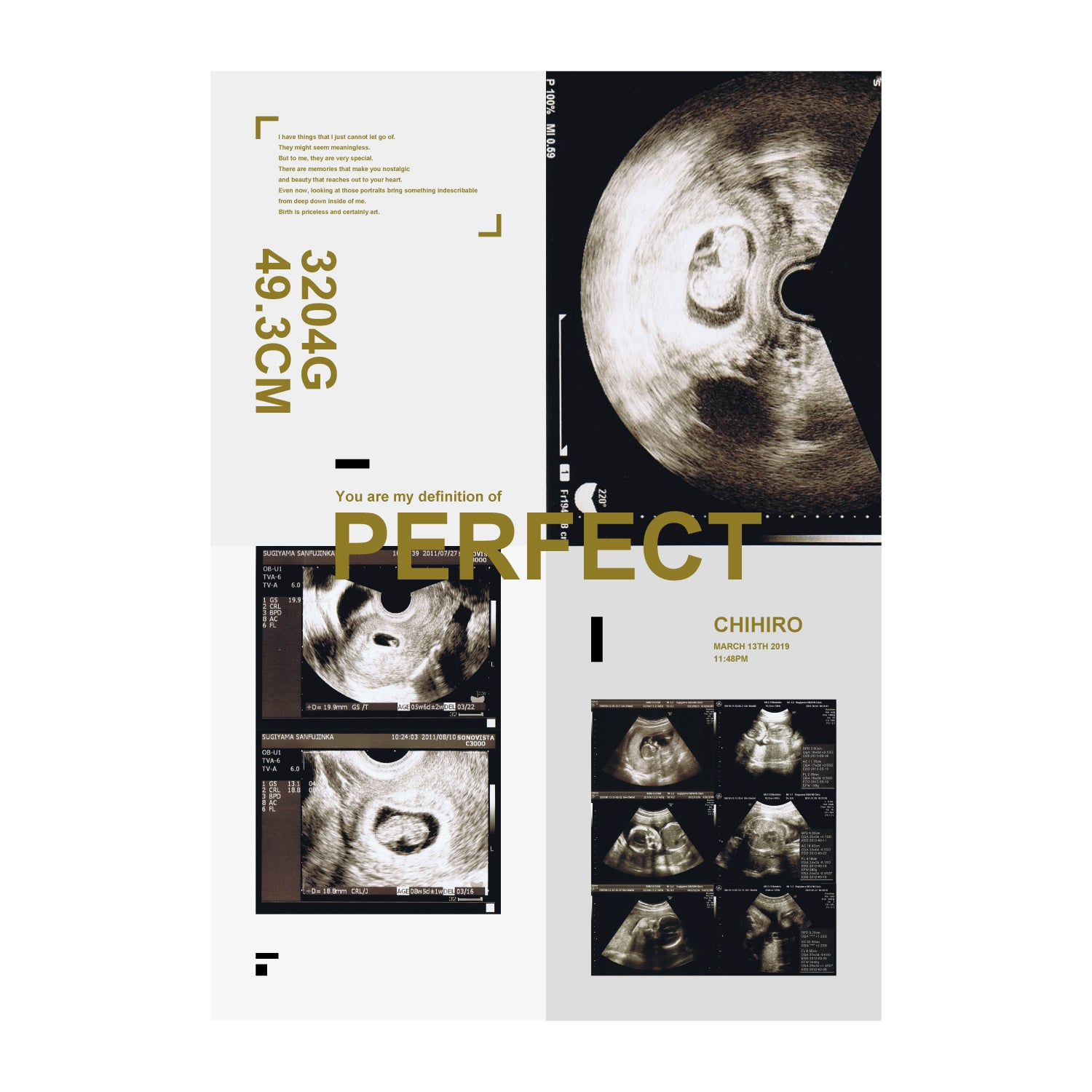 PERFECT - beige 【Ultrasound Poster】