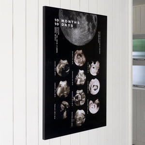 Open image in slideshow, 10M10D - black 【Ultrasound Poster】

